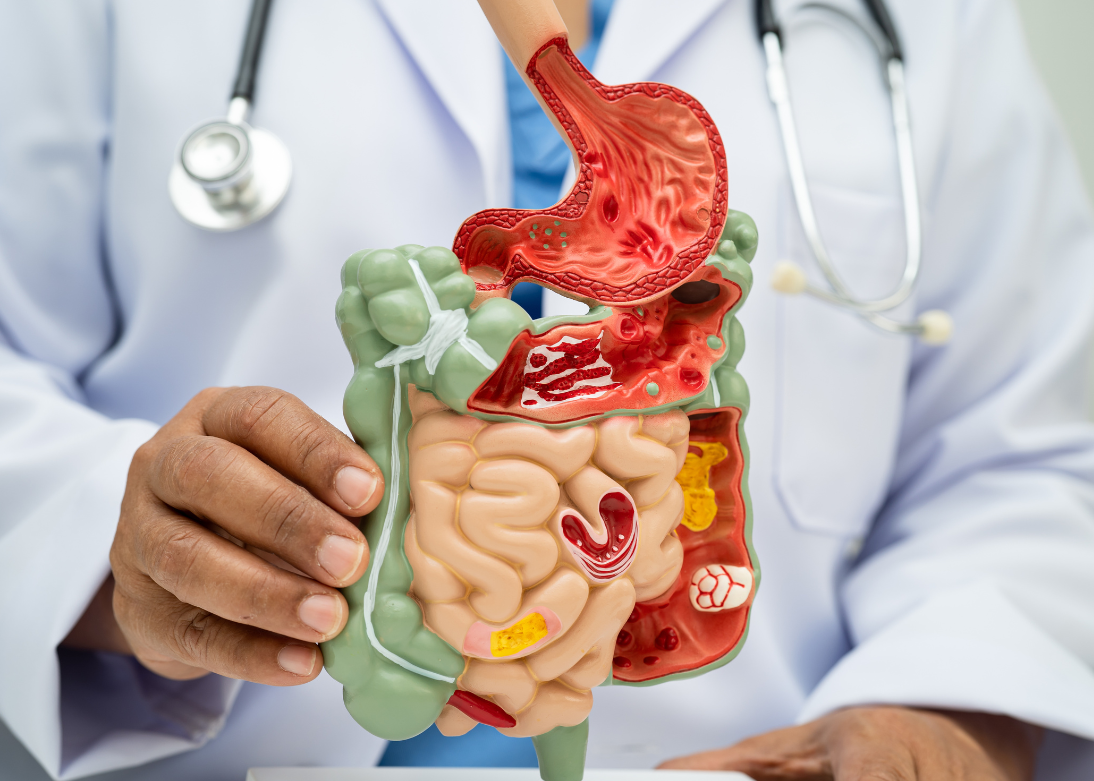 IBS Treatment